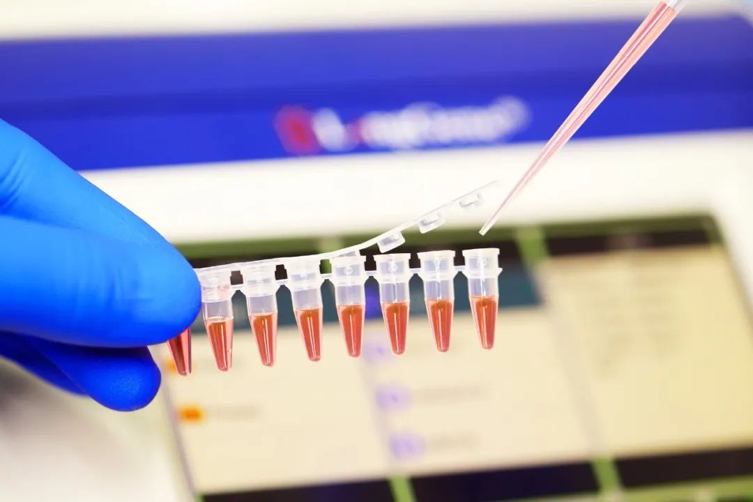 PCR/qPCR የፍጆታ ዕቃዎችን እንዴት መምረጥ ይቻላል?